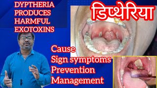 DIPTHERIA डिप्थेरिया बैक्टीरिया में जानलेवा EXOTOXINS infectiousdisease [upl. by Ecnarretal]