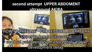 How to prepare fasting for whole abdomen ultrasound upper abdomen [upl. by Johann]