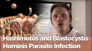 Hashimotos and Blastocystis Hominis Parasite Infection  The Infection Connection [upl. by Lehmann587]