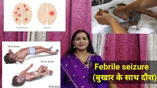 Febrile ConvulsionSeizure in childrenFever with convulsions बुखार के साथ दौरातड़का drniteshraj [upl. by Lyontine898]