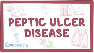 Peptic ulcer disease  causes symptoms diagnosis treatment pathology [upl. by Aniloj]