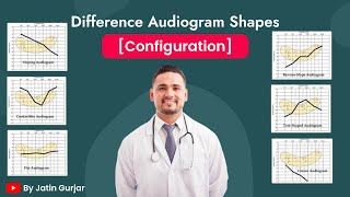 Different Audiogram Shapes Configuration [upl. by Reiniar]