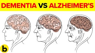 Dementia Vs Alzheimers How to Tell the Difference [upl. by Rellia]