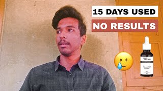 15 DAYS REVIEW OF MAN MATTERS MINOXIDIL 💀 No visible results 💀 Man matters beardmax 15 days review [upl. by Zonda]