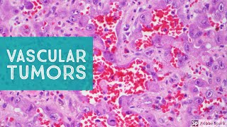 Vascular Tumors of the Skin  Explained by a Soft Tissue Pathologist [upl. by Tham338]