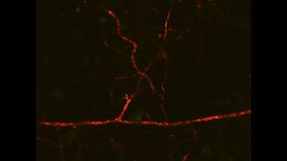 Arbuscular Mycorrhizal Symbiosis extraradical lipid flow 1 Live Imaging [upl. by Esina]