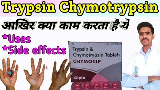 trypsin chymotrypsin tablet uses in hindi  trypsin bromelain rutoside trihydrate tablets  Trypsin [upl. by Nbi508]