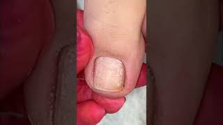 Nails ASMR bennailcom asmr nails pedicure satisfying [upl. by Dex565]