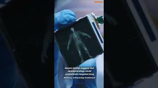 Nanotechnology in Medicine Miracle Cure or Hidden Danger medicalbreakthroughs medicaltechnology [upl. by Eural]