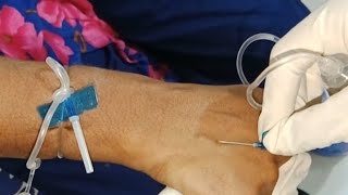 venipuncture using a butterfly needle [upl. by Taro944]