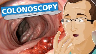 Colonoscopy [upl. by Dore130]