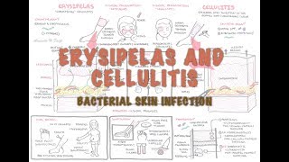 Bacterial Skin Infection  Cellulitis and Erysipelas Clinical Presentation Pathology Treatment [upl. by Eixid]