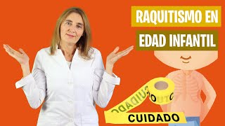 El RAQUITISMO en la EDAD INFANTIL  ¿Sabes qué es el raquitismo  Nutrición infantil [upl. by Evad]