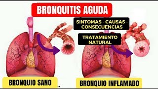 Bronquitis  Como Curar La Bronquitis  Remedios Caseros Para Tratar La Bronquitis tos [upl. by Eryt]