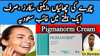 pigmanorm cream uses treatment of face frecklesacne scarspimple scarsHyperpigmentation [upl. by Errot417]