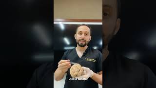 Entenda o nome dos lobos cerebrais 🧠 anatomia neuroscience cerebro [upl. by Nerret]