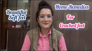 How to treat cracked heels at home Remedies for Cracked heels [upl. by Oly782]