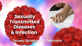 sexually transmitted disease  STD  std aids hiv disease herpessimplex genitalherpes mbbs [upl. by Tegirb521]