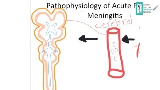 Meningitis Part 1 [upl. by Thaddus]