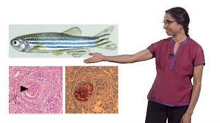 Lalita Ramakrishnan Cambridge 2 The Troublesome Tubercle in Tuberculosis [upl. by Nnodnarb128]