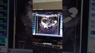 X ray  fluoroscopy procedure  fluoroscopy trending viral shorts arabic [upl. by Nyletac455]