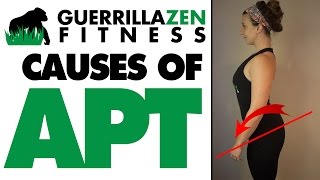 Anterior Pelvic Tilt CAUSES amp Exercises To AVOID [upl. by Griffith]