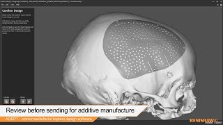 ADEPT  craniomaxillofacial design for 3D printing [upl. by Shoshana]