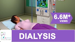 Procedure of DIALYSIS [upl. by Vashti]