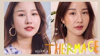 รีวิวทำ THERMAGE หน้าเล็กลงแบบไม่ต้องพึ่งเข็ม คุ้มไหม มันคืออะไรใครสงสัยต้องดู   Brinkkty [upl. by Neemsay]