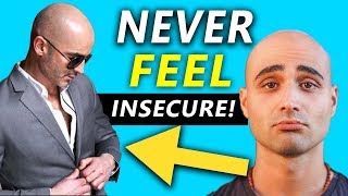 Insecure about Hair Loss while Socializing FOR YOUNG GUYS [upl. by Greene]