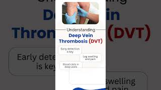 Deep Vein Thrombosis DVT  Deep Vein Thrombosis Treatment  Dr Nikhil Bansal  Jaipur [upl. by Shellans]