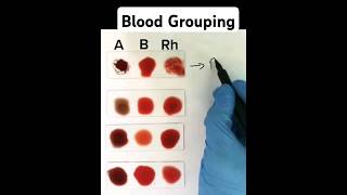 Blood Grouping made easy [upl. by Guevara]