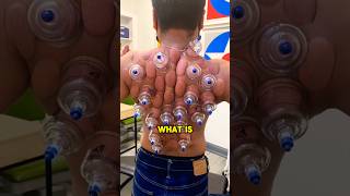 This is an extremely strange procedure 😲viral satisfying weird shorts [upl. by Montana]