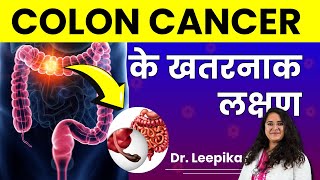 Colon Cancer Kya Hai Kyu Hota Hai Causes amp Symptoms of Colon Cancer in Detail [upl. by Asnarepse413]