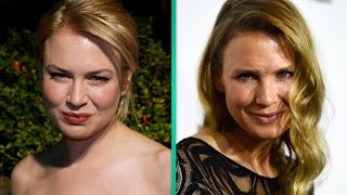 What Did Renee Zellweger Do to Her Face Plastic Surgeon Weighs In [upl. by Merth]