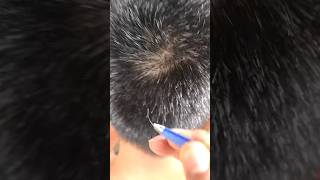 Grey hair removal 36 [upl. by Beard]