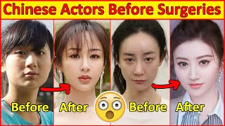 Chinese Actors Before and After Plastic Surgeries 😮  Incredible Changes Chinese Drama [upl. by Pros400]