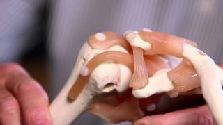 Treating Stiff Joints [upl. by Aklam]