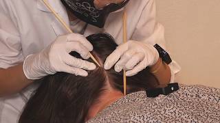 ASMR Examining Skin LESIONS on SCALP  Inspection with Sticks Real Person [upl. by Googins]