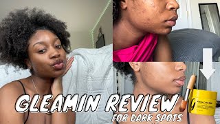 Gleamin Review The Best Face Mask for Hyperpigmentation Does it REALLY work with pictures [upl. by Ehcram]