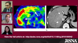 Elastography in Chronic Liver Disease Modalities Techniques Limitations and Future Directions [upl. by Houston]