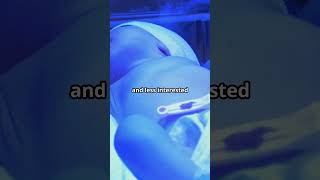 Newborn Jaundice What You Need to Know babycare pediatrichealth baby parentingtips newborn [upl. by Cannell]