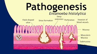 Pathogenesis of Entamoeba histolytica  parasitology  Basic Science Series [upl. by Ohcamac199]