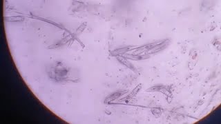 Demodectic Mange in Dogs  Microscopic View [upl. by Dzoba490]