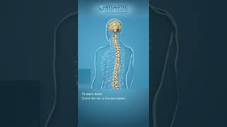 What is Cervical Lateral Stenosis Shorts [upl. by Aisayn343]