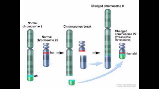 Chronic Myelocytic Leukemia [upl. by Nirtiak]