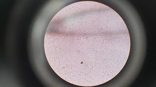 Semen Analysis Test  Microscopic Examination of Semen Test  Semen Test Procedure [upl. by Greene]