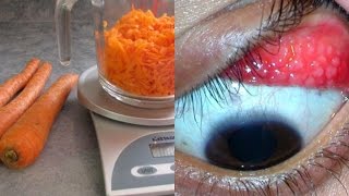 If You Eat 2 Carrots Per Day For A Month This Is What Happens To Your Eyes [upl. by Eecrad]