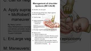 Management of shoulder dystocia BE CALM [upl. by Nalrah419]