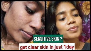 Sensitive skin care routine and get clear skin in just one day [upl. by Lahcar610]